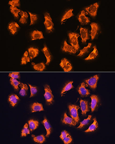 alpha Sarcoglycan (SGCA) Rabbit polyclonal antibody