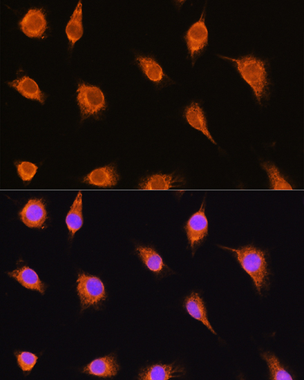 alpha Sarcoglycan (SGCA) Rabbit polyclonal antibody