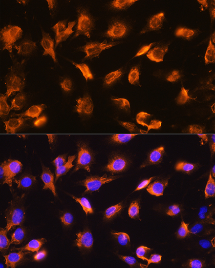 alpha Sarcoglycan (SGCA) Rabbit polyclonal antibody