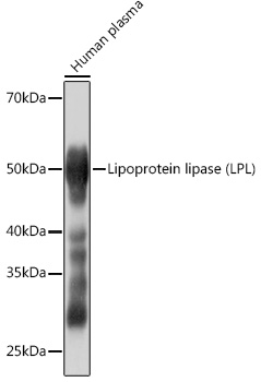 Lipoprotein lipase (LPL) Rabbit monoclonal antibody