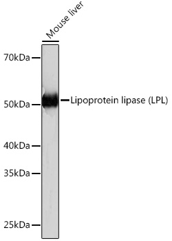 Lipoprotein lipase (LPL) Rabbit monoclonal antibody