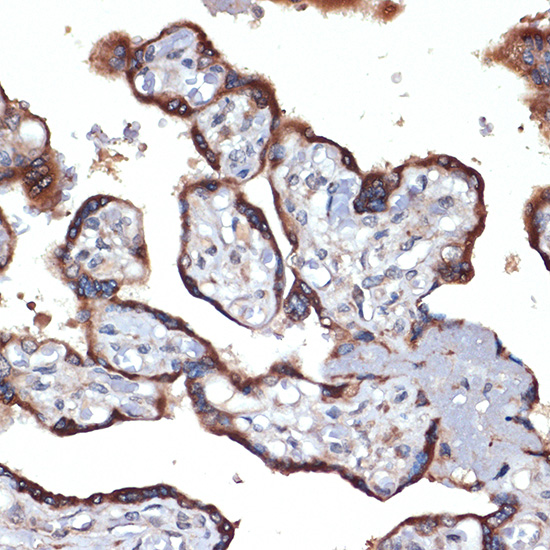TMEFF2 Rabbit monoclonal antibody