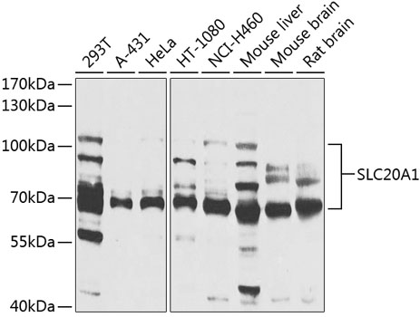 SLC20A1 Rabbit polyclonal antibody