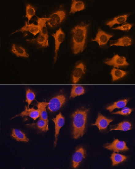 SLC20A1 Rabbit polyclonal antibody