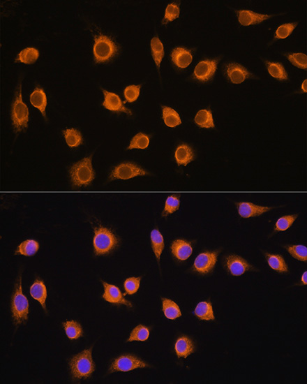 SLC20A1 Rabbit polyclonal antibody