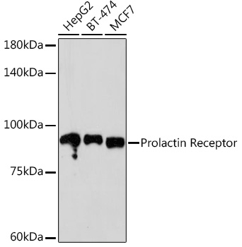 Prolactin Receptor Rabbit mAb