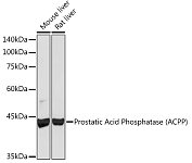 Western blot - Prostatic Acid Phosphatase (ACPP) Rabbit mAb (A4138)