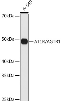 AT1R/AGTR1 Rabbit mAb