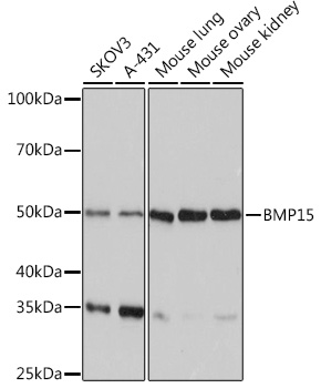 BMP15 Rabbit monoclonal antibody