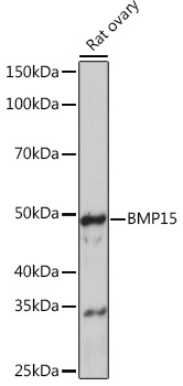 BMP15 Rabbit monoclonal antibody