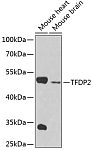 Western blot - TFDP2 Rabbit pAb (A4152)