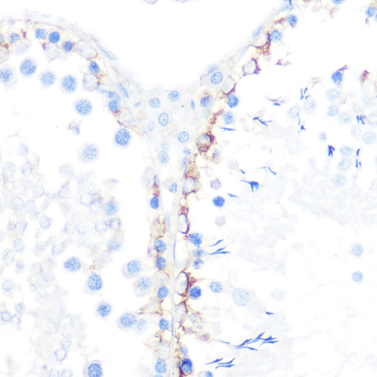 G Gamma-Catenin Rabbit monoclonal antibody