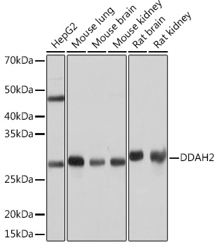 DDAH2 Rabbit mAb