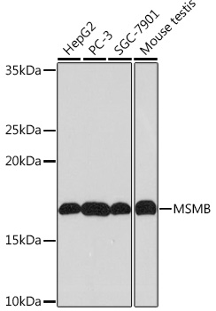 MSMB Rabbit monoclonal antibody