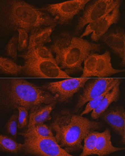 MSMB Rabbit monoclonal antibody