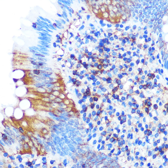 PGAM1 Rabbit monoclonal antibody