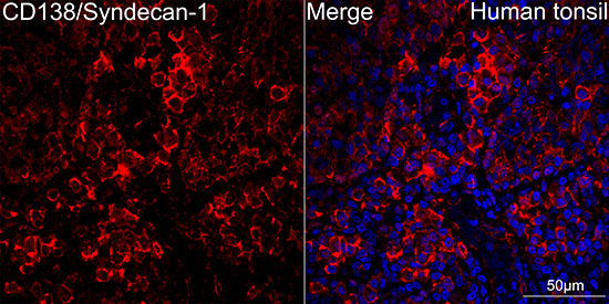 CD138/Syndecan-1 Rabbit monoclonal antibody