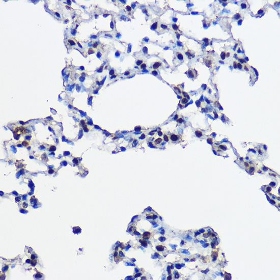 UBE2L3 Rabbit polyclonal antibody