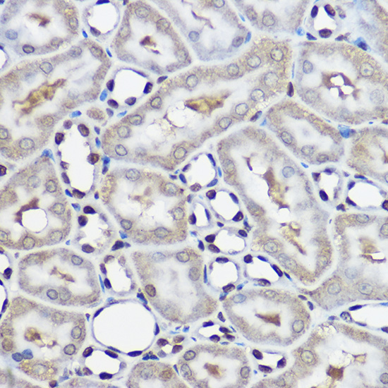 UBE2L3 Rabbit polyclonal antibody