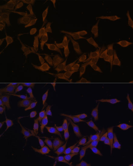 UBE2L3 Rabbit polyclonal antibody