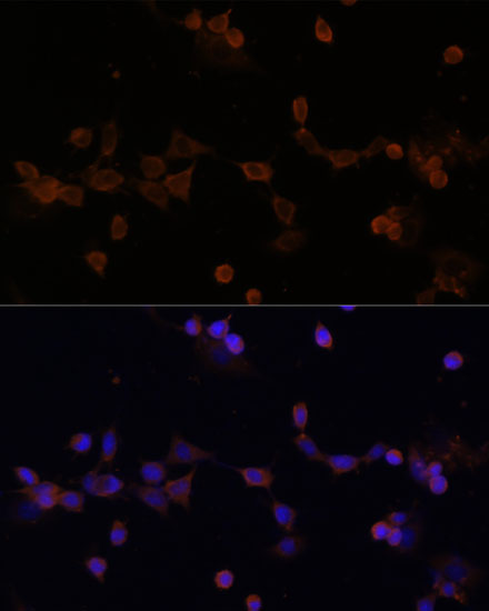 UBE2L3 Rabbit polyclonal antibody