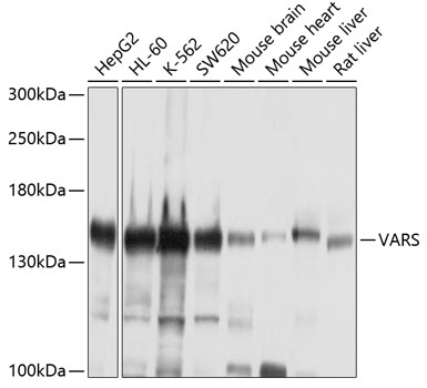 VARS Rabbit polyclonal antibody