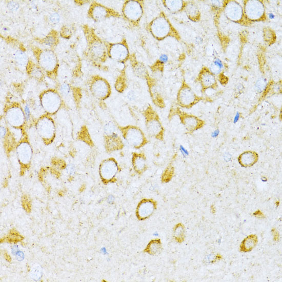 VARS Rabbit polyclonal antibody