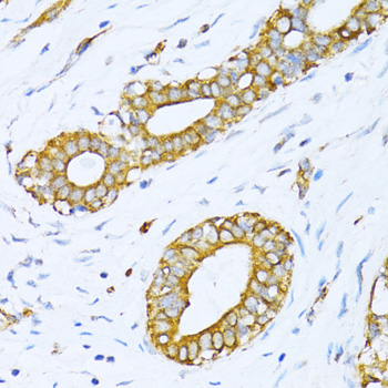 VARS Rabbit polyclonal antibody