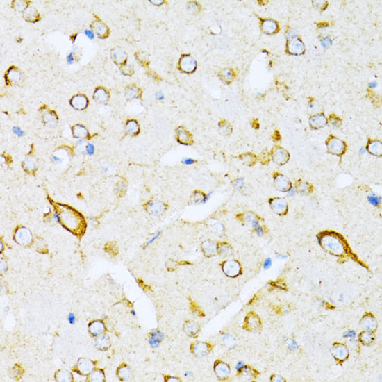 VARS Rabbit polyclonal antibody