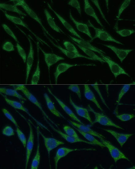 VARS Rabbit polyclonal antibody