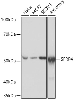 SFRP4 Rabbit monoclonal antibody