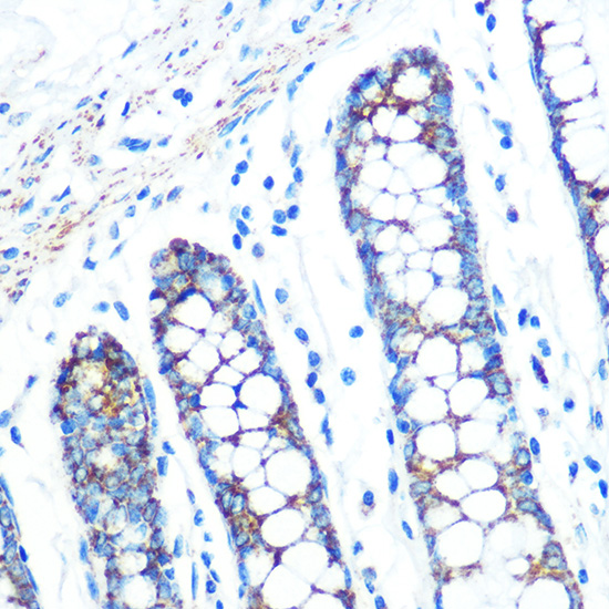 SFRP4 Rabbit monoclonal antibody
