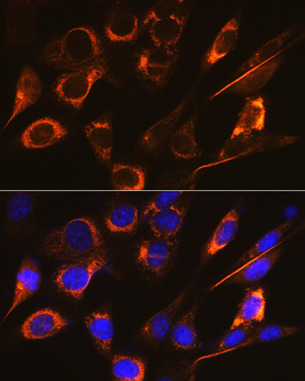 SFRP4 Rabbit monoclonal antibody