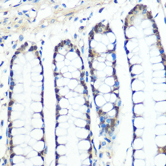 Chk1 Rabbit monoclonal antibody