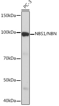 NBS1/NBN Rabbit monoclonal antibody