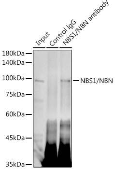 NBS1/NBN Rabbit monoclonal antibody