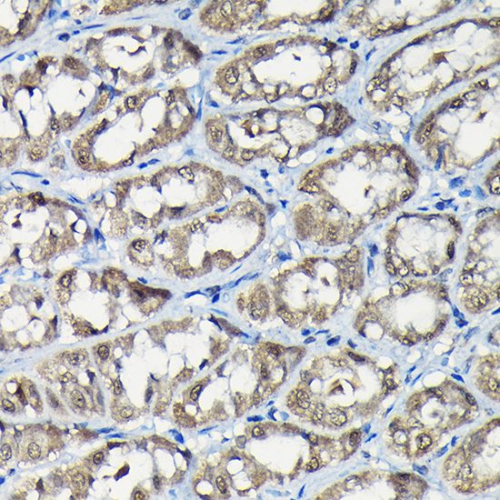 USP5 Rabbit polyclonal antibody