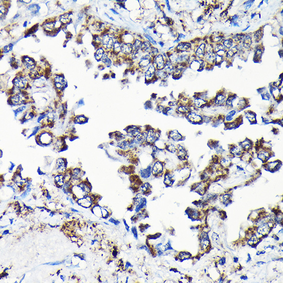 USP5 Rabbit polyclonal antibody