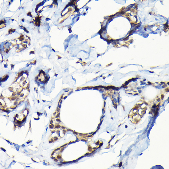USP5 Rabbit polyclonal antibody