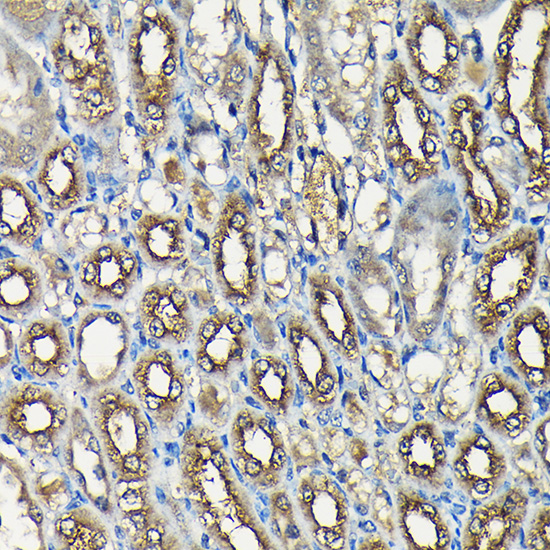 USP5 Rabbit polyclonal antibody