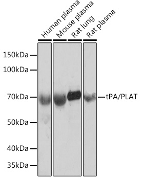 tPA/PLAT Rabbit monoclonal antibody