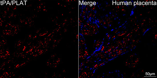 tPA/PLAT Rabbit monoclonal antibody