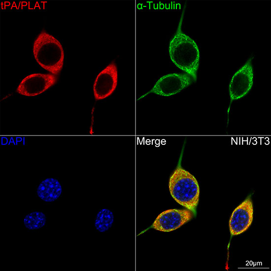 tPA/PLAT Rabbit monoclonal antibody