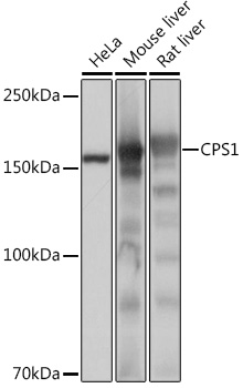 CPS1 Rabbit monoclonal antibody