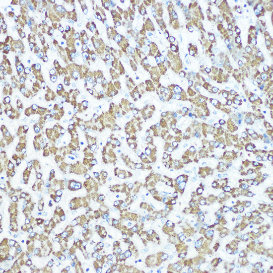 CPS1 Rabbit monoclonal antibody