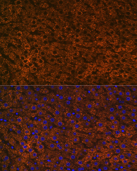 CPS1 Rabbit monoclonal antibody