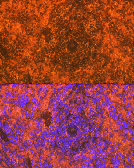 CD83 Rabbit monoclonal antibody