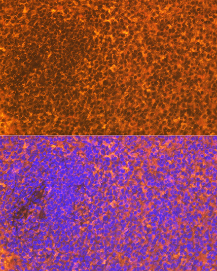 CD83 Rabbit monoclonal antibody