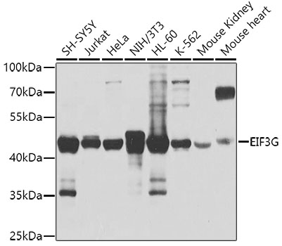 EIF3G Rabbit polyclonal antibody