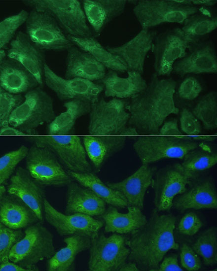 EIF3G Rabbit polyclonal antibody